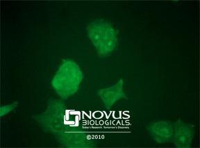 NOV社 グラフィックス