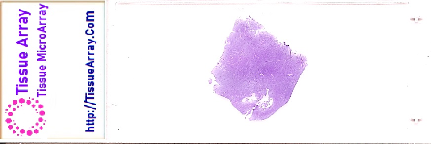 パラフィン包埋切片